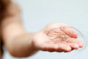 Read more about the article Is Hair Loss Treatment Worth It for Long-Term Hair Regrowth? 