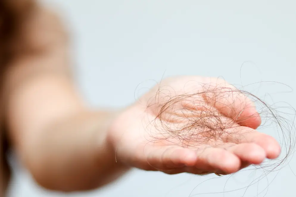 Read more about the article Is Hair Loss Treatment Worth It for Long-Term Hair Regrowth? 